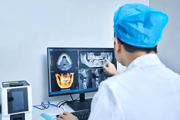 Best Emergency Wisdom Tooth Extraction in Onsted, MI